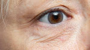 under eye wrinkles and signs of aging