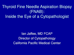 Fine needle aspiration cytology and histology did not correlate in 32 (20 per cent) patients and fnac was inadequate in nine (5.6 per cent) cases. Ppt Thyroid Fine Needle Aspiration Biopsy Fnab Inside The Eye Of A Cytopathologist Powerpoint Presentation Id 4111590
