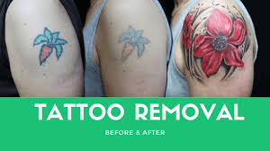 Removal of a tattoo takes time, affords patience, and obviously costs money. Tattoo Removal Methods And Their Effects