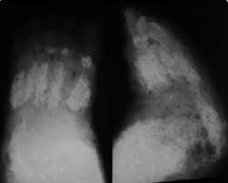 If you can try with suitable image, you can also diy at home.if you want to do it fast, just work around with the level tool in gimp to see to what extent you. Image Preparation Radiology Reference Article Radiopaedia Org