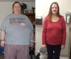 patient jennifer sievers before and after photos