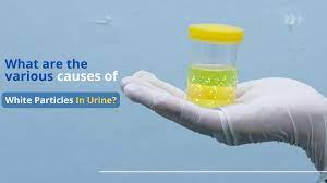 symptoms of white particles in urine