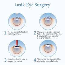 At age 60, the eyes start to change once more. What Does Lasik Eye Surgery Feel Like Optilase Laser Eye Surgery
