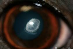 corneal dystrophy eye care for
