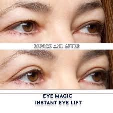 eye magic premium instant eyelid lift