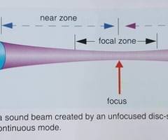 chp 9 sound beams flashcards quizlet