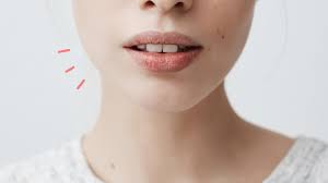 Asam laktat yang terkandung dalam susu ternyata efektif untuk mengurangi flek dan noda hitam di bibir. Kenali Penyebab Bibir Bruntusan Dan Cara Mengatasinya Orami