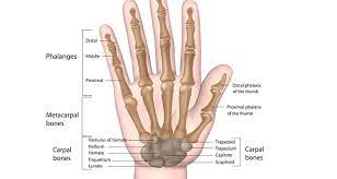 broken hand metacarpal fracture
