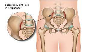 sacroiliac joint pain during pregnancy