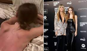 Heidi Klum's daughter Leni posts topless picture displaying her  painful