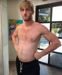 Logan paul admitted to having sociopathic tendencies, but he also admits to wanting to have wallpapered his room with flowers when he was a kid amongst other weird behaviors that weren't. Matej 12