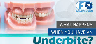 There are different types of treatment for under bite correction that use porcelain veneers and cosmetic dentistry that is just can braces fix an underbite. What Happens When You Have An Underbite 1st Family Dental Blog