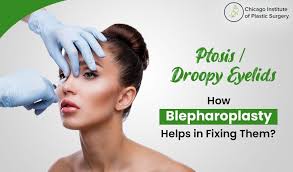 fixing ptosis droopy eyelids