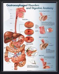 Gastroesophageal Disorders Anatomy Poster Illustrates