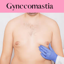 best gynecomastia surgery cost 100