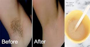 remove underarm hair without waxing