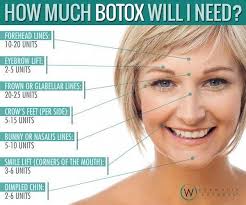Image Result For Botox Injection Sites Diagram