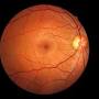 Retina Optic from my.clevelandclinic.org