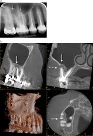 dental cone beam ct a review physica