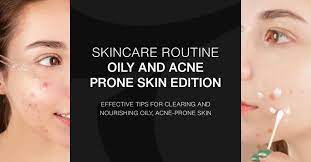 skincare routine oily and acne e