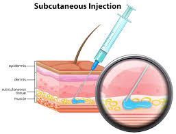 intramuscular testosterone injections