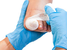about ingrown toenail surgery