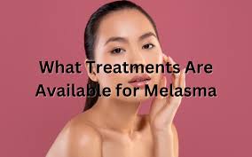 treatments are available for melasma