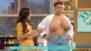 This woman got a breast exam on live TV. No bra, no blurring. Here's why.