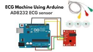 how to make ecg machine using arduino
