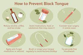 black tongue causes symptoms