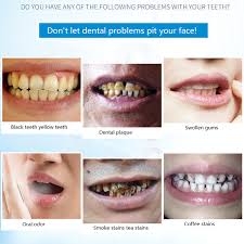 Prevent future stains on teeth. Teeth Whitening 50 Grams Remove Smoke Stains Coffee Stains Tea Stains Fresh Breath Bad Breath Oral Hygiene Dental Care Teeth Whitening Aliexpress