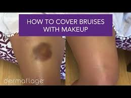 leg bruise makeup