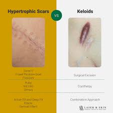 best treatments for all types of scars