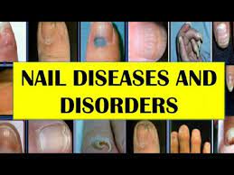 nail diseases and disorders you