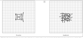 Figure 1 From The Visual Performance And Metamorphopsia Of