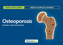 Osteoporosis Nursing Care Management And Study Guide