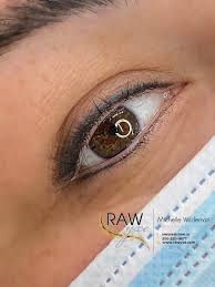 raw yxe cosmetic enhancement clinic