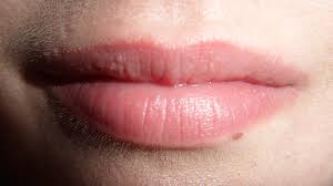 small white ps on lips causes and