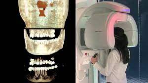 cone beam ct and 3d imaging you