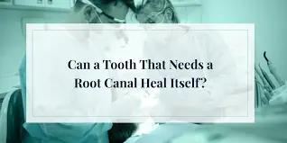 can-a-tooth-that-needs-a-root-canal-heal-itself