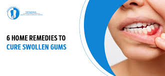 6 home care tips to cure swollen gums