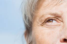 non surgical fi for eye wrinkles