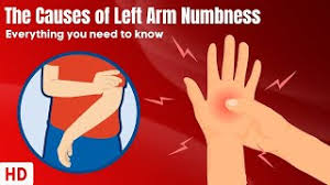 the causes of left arm numbness you