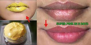 cure dark lips naturally