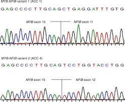 myb nfib gene fusions identified in