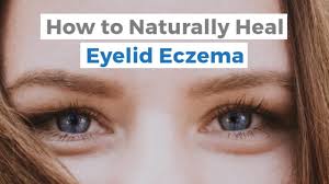best eczema on eyelid treatment options