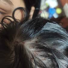 Lice are tiny, wingless, parasitic insects that feed on human blood. Hi Doctors My Baby Is 6 Month Old He Got Lice In His Hair And Is Scratching His Head Due To Itching I Tried Removing It Using Lice Comb But It Is Not Getting Removed