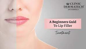 a beginners guide to lip filler treatment