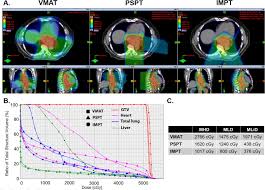proton therapy for esophageal cancer