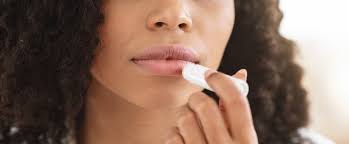 how to prevent and treat chapped lips
